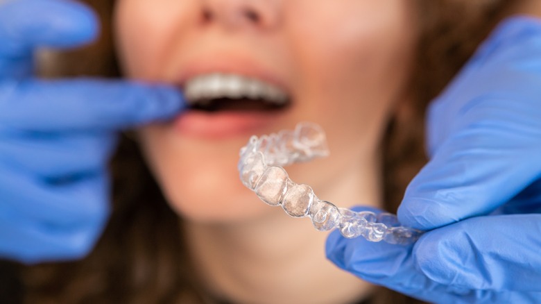 Orthodontist fitting an Invisalign